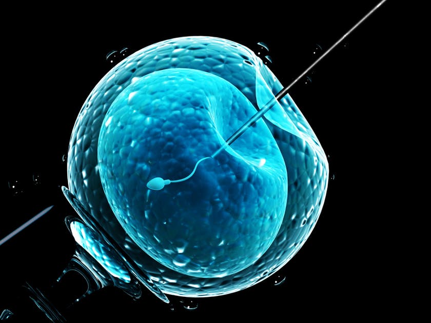 fecondazione artificiale - uno spermatozoo viene inserito in una cellula uovo (FIV o FIVET)